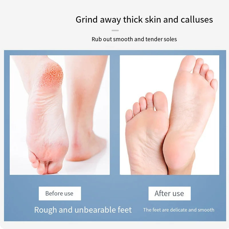 Professional Stainless Steel Foot File Double Sided Foldable Dead Skin Callus Remover Pedicure Tools Exfoliate Scrubber Grater